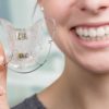 Zahnspange für Kinder: Hintergründe, Behandlungsmethoden