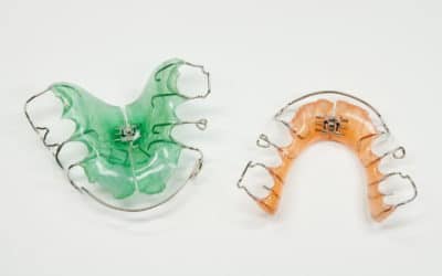 Lose Zahnspangen: Alles wissenswerte und alle Kosten zu den herausnehmbaren Spangen