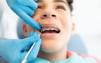 Ein Teenager mit einer festen Zahnspange liegt auf einem Behandlungsstuhl während eines Kontrolltermins