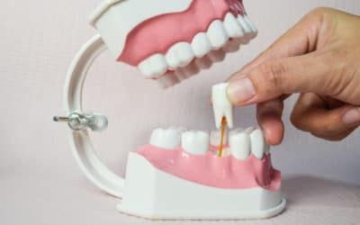 Zahn wird mit dem Finger aus einem Zahnmodell gezogen