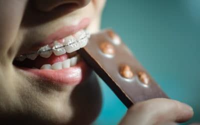 Frau beißt mit einer festen Zahnspange von der Schokolade ab