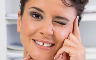 Erwachsene Frau lächelt mit einer großen Zahnlücke im Frontzahnbereich